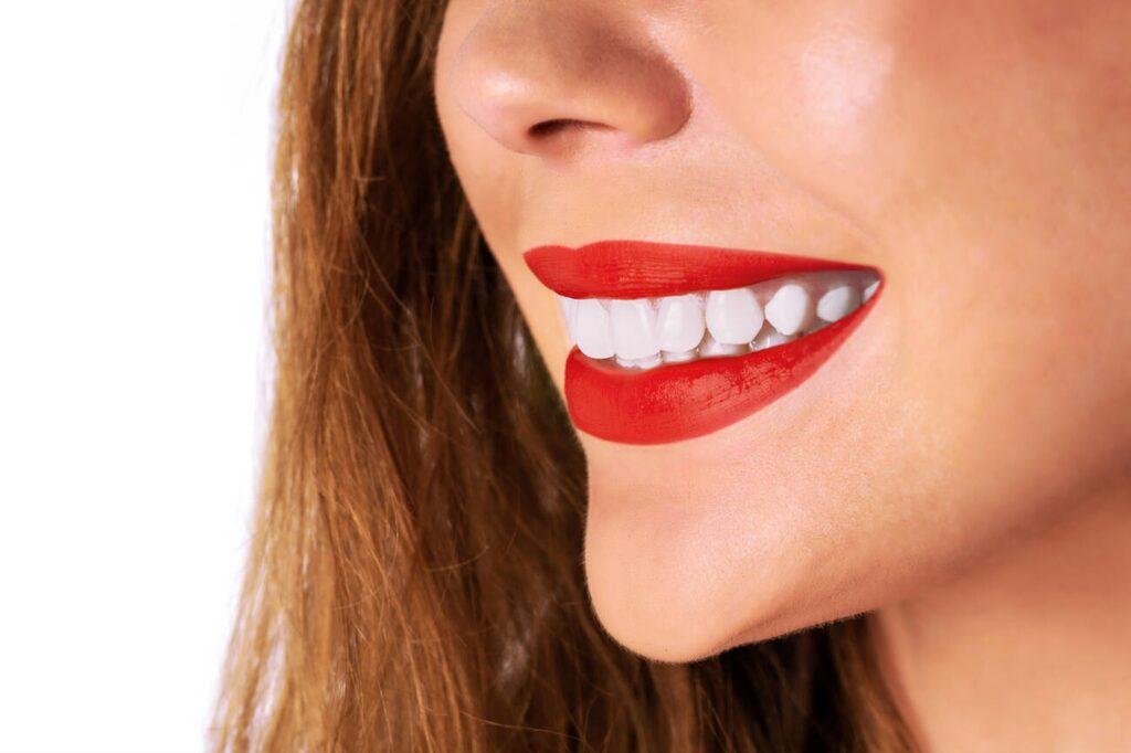 Understanding Tooth Whitening